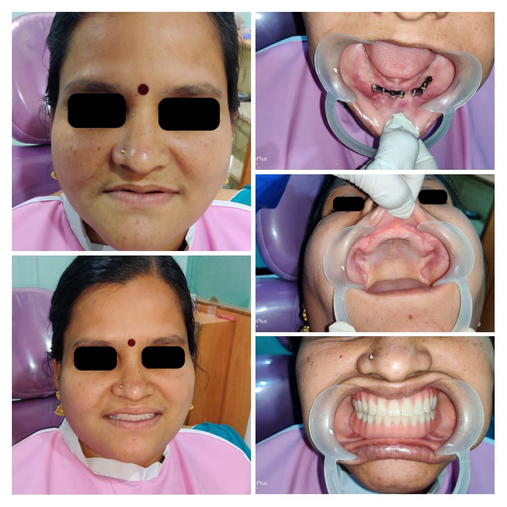 Before and After Case 1