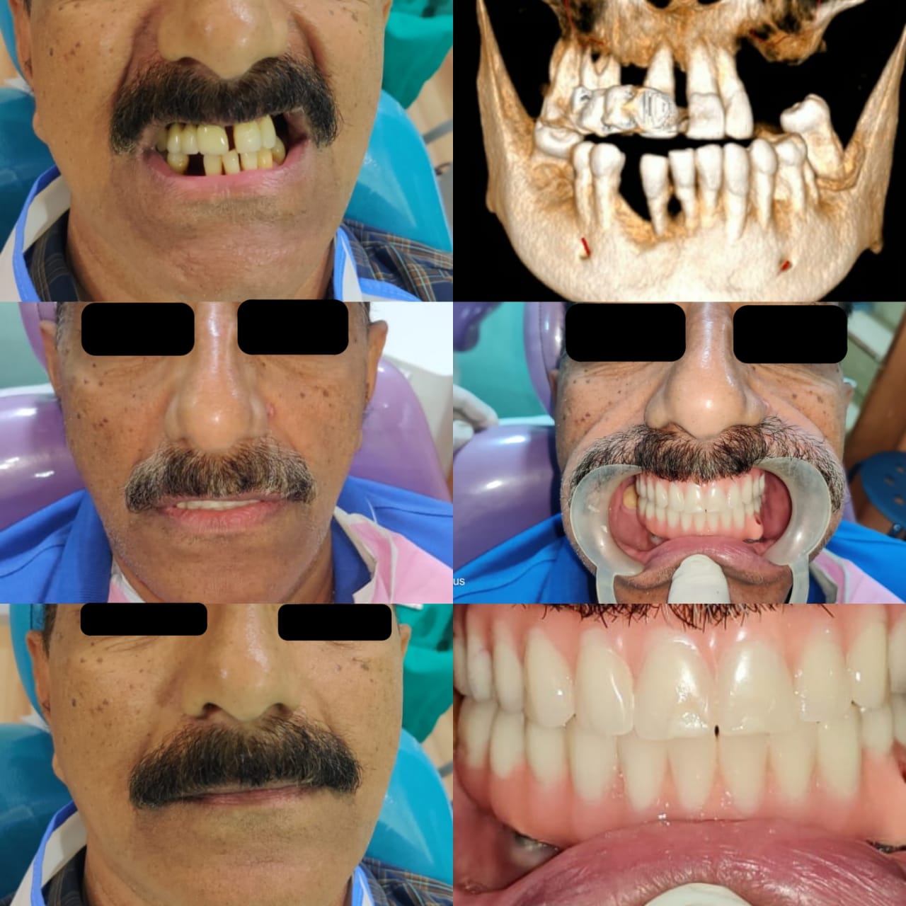 Before and After Case 1