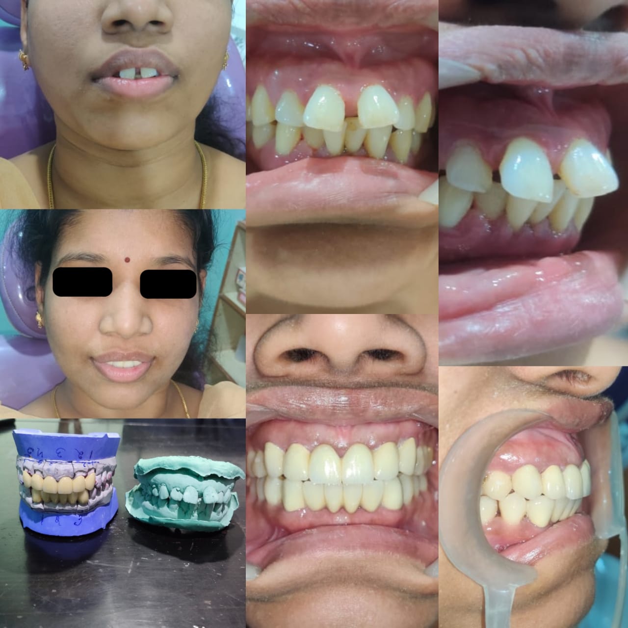 Before and After Case 2